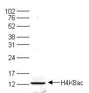 Histone extracts of HeLa cells (15 μg) were analyzed by Western blot using the Bioss antibody directed against H4K8ac (cat. No. bs-53133R) diluted 1:200 in TBS-Tween containing 5% skimmed milk.