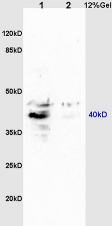 L1 human colon carcinoma lysates L2 rat brain lysates probed with Anti GPR15 Polyclonal Antibody, Unconjugated (bs-3699R) at 1:200 overnight at 4˚C. Followed by conjugation to secondary antibody (bs-0295G-HRP) at 1:3000 for 90 min at 37˚C. Predicted band 40kD. Observed band size:40kD.\n