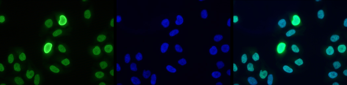 HeLa cells were stained with H3K9me3S10p Polyclonal Antibody (bs-53072R) and with DAPI. Cells were fixed with 4% formaldehyde for 10’ and blocked with PBS/TX-100 containing 5% normal goat serum and 1% BSA. The cells were immunofluorescently labeled with H3K9me3S10p antibody (left) diluted 1:500 in blocking solution followed by an anti-rabbit antibody conjugated to Alexa488. The middle panel shows staining of the nuclei with DAPI. A merge of the two stainings is shown on the right.