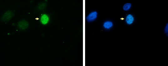 Hela asynchronous cells were stained with the antibody against H3S10p (bs-53069R) and with DAPI. Cells were fixed with formaldehyde, permeabilized with sodium citrate and Triton X100 and blocked with PBS containing 2.5% BSA. (left) Cells were immunofluorescently labeled with the H3S10p antibody (diluted 1:200 and incubated for 1 hour at room temperature) followed by goat anti-rabbit antibody conjugated to DyLight 488. (right) The nuclei were stained with DAPI, which specifically labels DNA. Phosphorylation of H3 on serine 10 occurs on condensed chromosomes during mitosis. This explains the dense staining of one of the cells (indicated by an arrow) in the figure.