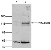 Human embryonic kidney cells (293T) were transfected with an ER-tagged PML/RAR fusion protein. Nuclear extracts (50 μg) from control (lane 1) and from transfected cells (lane 2) were analyzed by Western blot using PML Polyclonal Antibody (Cat. No. bs-53134R). The antibody was diluted 1:750 in TBS-Tween containing 5% milk powder. The smaller band of approximately 60 kDa might represent the endogenous PML protein.