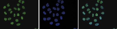 Mouse NIH3T3 cells were stained with H4K8ac Polyclonal Antibody (cat. No. bs-53133R) and with DAPI. Cells were fixed with 4% formaldehyde for 10’ and blocked with PBS/TX-100 containing 5% normal goat serum and 1% BSA. The cells were immunofluorescently labeled with the H4K8ac antibody (left) diluted 1:500 in blocking solution followed by an anti-rabbit antibody conjugated to Alexa488. The middle panel shows staining of the nuclei with DAPI. A merge of the two stainings is shown on the right.