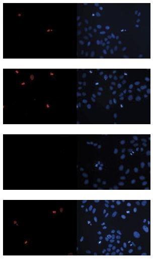 Human osteosarcoma (U2OS) cells were stained with H3S10p Polyclonal Antibody (bs-53135R) and with DAPI. Cells were fixed with 3.7% formaldehyde in PBS for 20’ at RT, followed by a 20’ permeabilization with 0.5% Triton X-100 in PBS and blocked PBS/TX-100 containing 5% normal goat serum Figure A: cells were immunofluorescently labeled with the H3S10p antibody (left) diluted 1:2,000 in blocking buffer followed by an anti-rabbit antibody conjugated to Alexa568 or with DAPI (right). Figure B, C and D: staining of the cells with the H3S10p antibody after incubation of the antibody with 2 μM blocking peptide containing the unmodified H3S10 sequence, the phosphorylated H3S10, and the phosphorylated H3T11, respectively.