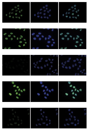 HeLa cells were stained with the Bioss antibody against H4K5,8,12ac (cat. No. bs-53096R) and with DAPI. Cells were fixed with 4% formaldehyde for 10’ and blocked with PBS/TX-100 containing 5% normal goat serum and 1% BSA. Figure A: cells were immunofluorescently labeled with the H4K5,8,12ac antibody (left) diluted 1:500 in blocking solution followed by Alexa488 conjugated secondary antibody. The middle panel shows staining of the nuclei with DAPI. A merge of the two stainings is shown on the right. Figure B, C, D, and E: staining of the cells with the H4K5,8,12ac antibody after incubation of the antibody with 10 ng/μl of the following blocking peptides: H4K5,8,12 unmodified (figure B), H4K5,8,12ac (figure C), H2A.ZK5,7,11ac (figure D) and H4K5,8,12,16ac (figure E).