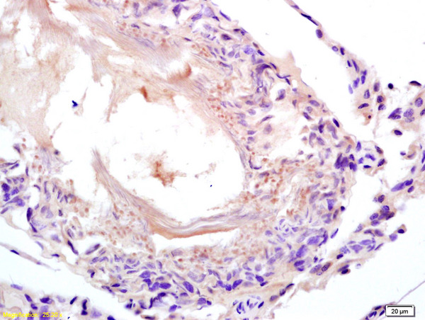 Formalin-fixed and paraffin embedded rat testis labeled with Anti-LDHC/Cancer,testis antigen 32 Polyclonal Antibody, Unconjugated (bs-3827R) at 1:200 followed by conjugation to the secondary antibody and DAB staining. Formalin-fixed and paraffin embedded rat testis labeled with Anti-LDHC/Cancer,testis antigen 32 Polyclonal Antibody, Unconjugated (bs-3827R) at 1:200 followed by conjugation to the secondary antibody and DAB staining.