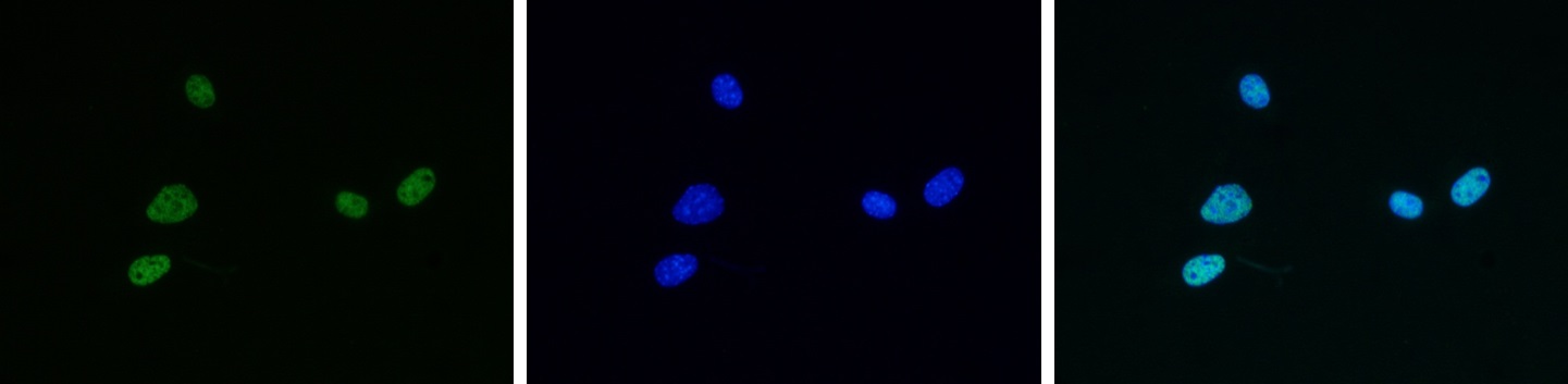 Mouse NIH3T3 cells were stained with Bioss antibody against H4K5,8,12,16ac (cat. No. bs-53098R) and with DAPI. Cells were fixed with 4% formaldehyde for 10’ and blocked with PBS/TX-100 containing 5% normal goat serum and 1% BSA. The cells were immunofluorescently labeled with the H4K5,8,12,16ac antibody (left) diluted 1:500 in blocking solution followed by an anti-rabbit antibody conjugated to Alexa488. The middle panel shows staining of the nuclei with DAPI. A merge of the two stainings is shown on the right.