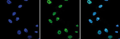 HeLa cells were stained with the Bioss antibody against WDR5 (Cat. No. bs-53101R) and with DAPI. Cells were fixed with 4% formaldehyde for 10’ and blocked with PBS/TX-100 containing 5% normal goat serum and 1% BSA. The cells were immunofluorescently labeled with the WDR5 antibody (left) diluted 1:1,000 in blocking solution followed by an anti-rabbit antibody conjugated to Alexa488. The middle panel shows staining of the nuclei with DAPI. A merge of the two stainings is shown on the right.