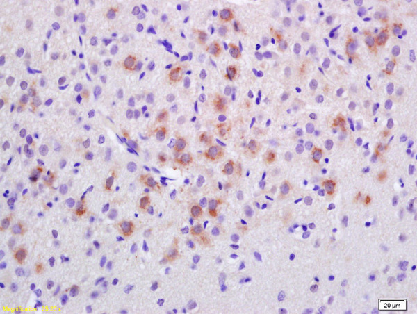 Formalin-fixed and paraffin embedded rat brain labeled with Anti-EPS8 Polyclonal Antibody, Unconjugated (bs-3848R) at 1:200 followed by conjugation to the secondary antibody and DAB staining.