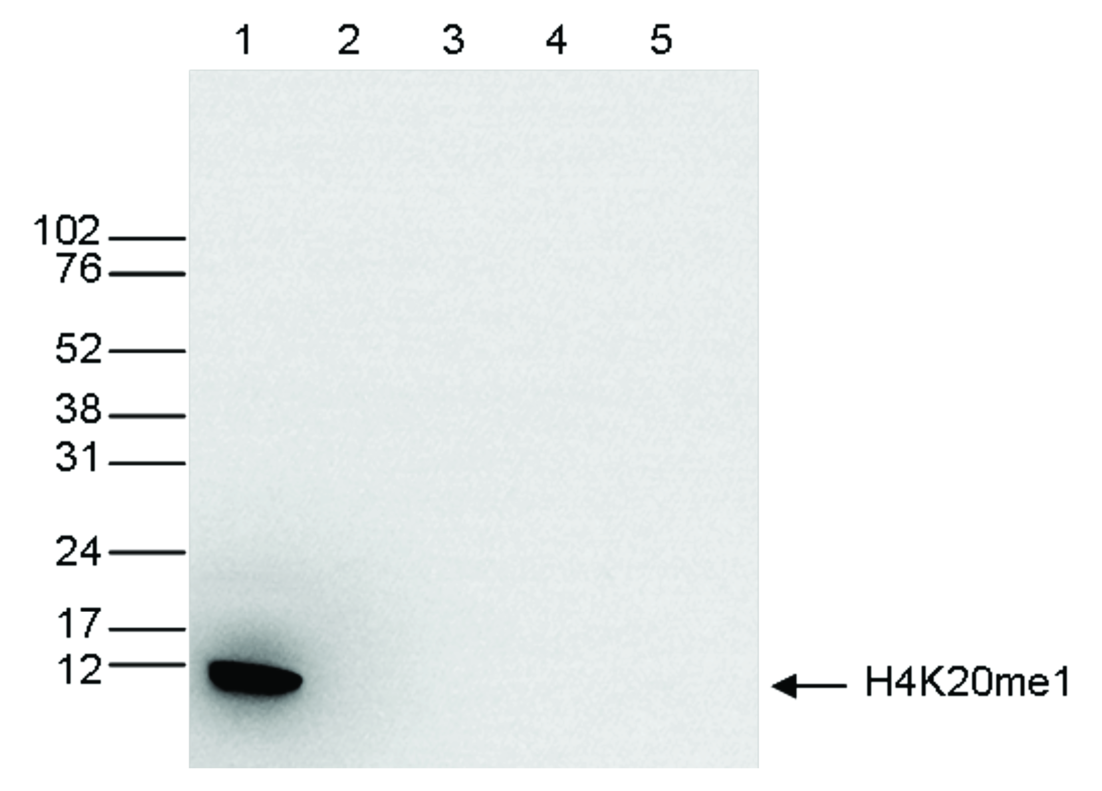 Western blot was performed on whole cell extracts (25 μg, lane 1) from HeLa cells, and on 1 μg of recombinant histone H2A, H2B, H3 and H4 (lane 2, 3, 4 and 5, respectively) using the Bioss antibody against H4K20me1 (cat. No. bs-53104R). The antibody was diluted 1:1,000 in TBS-Tween containing 5% skimmed milk. The marker (in kDa) is shown on the left, the position of the protein is indicated on the right.