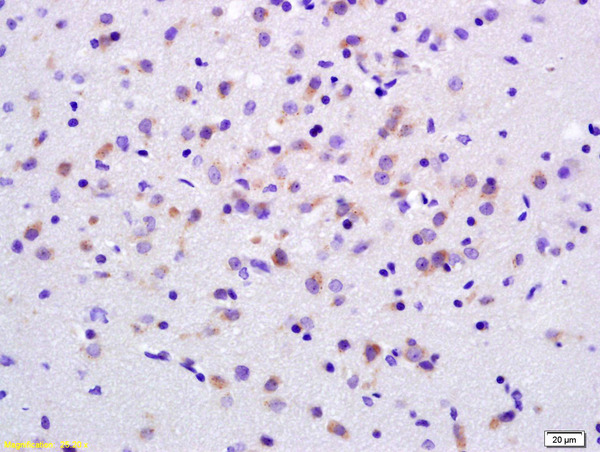 Formalin-fixed and paraffin embedded rat brain labeled with Anti-ADCY7 Polyclonal Antibody, Unconjugated (bs-3924R) at 1:200 followed by conjugation to the secondary antibody and DAB staining.
