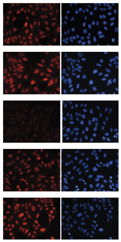 U2OS cells were stained with the Bioss antibody against H3K27me1 (Cat. No. bs-53108R) and with DAPI. Cells were fixed with 4% formaldehyde for 20’ and blocked with PBS/TX-100 containing 5% normal goat serum. Figure A: cells were immunofluorescently labeled with the H3K27me1 antibody (left) diluted 1:1,000 in blocking solution followed by an anti-rabbit antibody conjugated to Alexa568 or with DAPI (right), which specifically labels DNA. Figure B, C, D, and E: staining of the cells with the H3K27me1 antibody after incubation of the antibody with 2 ng/μl blocking peptide containing the unmodified and the mono-, di- and trimethylated H3K27, respectively. U2OS cells were stained with the Bioss antibody against H3K27me1 (Cat. No. bs-53108R) and with DAPI. Cells were fixed with 4% formaldehyde for 20’ and blocked with PBS/TX-100 containing 5% normal goat serum. Figure A: cells were immunofluorescently labeled with the H3K27me1 antibody (left) diluted 1:1,000 in blocking solution followed by an anti-rabbit antibody conjugated to Alexa568 or with DAPI (right), which specifically labels DNA. Figure B, C, D, and E: staining of the cells with the H3K27me1 antibody after incubation of the antibody with 2 ng/μl blocking peptide containing the unmodified and the mono-, di- and trimethylated H3K27, respectively.