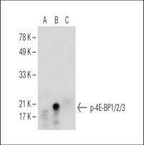 Western blot analysis of 4E-BP1/2/3 phosphorylation untreated (A), calyculin A treated (B) and calyculin A and lambda protein phosphatase treated (C) Jurkat whole cell lysates.