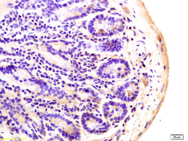Formalin-fixed and paraffin embedded mouse colon labeled with Anti-ADCY8 Polyclonal Antibody, Unconjugated (bs-3925R) at 1:200 followed by conjugation to the secondary antibody and DAB staining.