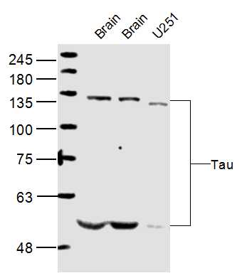 Lane 1: Brain(Mouse) lysates; Lane 2: Brain(Rat) lysates; Lane 3: U251 lysates probed with Tau protein Polyclonal Antibody, Unconjugated (bs-0157) at 1:300 dilution and 4˚C overnight incubation. Followed by conjugated secondary antibody incubation at 1:20000 for 60 min at 37˚C