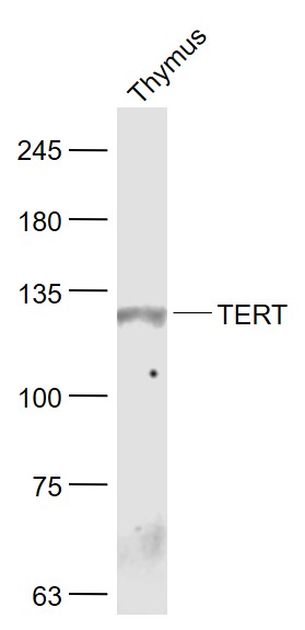 Thymus lysates probed with TERT Polyclonal Antibody, Unconjugated (bs-0233R) at 1:300 dilution and 4˚C overnight incubation. Followed by conjugated secondary antibody incubation at 1:20000 for 60 min at 37˚C