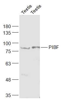 Lane 1: Testis (Mouse) lysates; Lane 2: Testis (Rat) lysates probed with PIBF Polyclonal Antibody, Unconjugated (bs-0420R) at 1:1000 dilution and 4˚C overnight incubation. Followed by conjugated secondary antibody incubation at 1:20000 for 60 min at 37˚C