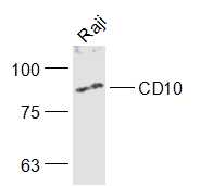 Raji lysates probed with CD10 Polyclonal Antibody, Unconjugated (bs-0527R) at 1:1000 dilution and 4˚C overnight incubation. Followed by conjugated secondary antibody incubation at 1:20000 for 60 min at 37˚C