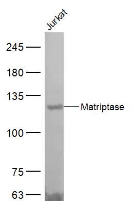 Lane 1: Jurkat lysates probed with Matriptase Polyclonal Antibody, Unconjugated (bs-0531R) at 1:300 dilution and 4˚C overnight incubation. Followed by conjugated secondary antibody incubation at 1:20000 for 60 min at 37˚C