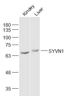 Lane 1: Mouse kidney lysates; Lane 2:Mouse liver lysates probed with SYVN1 Polyclonal Antibody, Unconjugated_x000D_ (bs-0679R) at 1:1000 dilution and 4˚C overnight incubation. Followed by conjugated secondary antibody_x000D_ incubation at 1:20000 for 60 min at 37˚C._x000D_