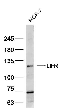 MCF-7 lysates probed with LIFR/CD118 Polyclonal Antibody, Unconjugated (bs-1458R) at 1:300 dilution and 4˚C overnight incubation. Followed by conjugated secondary antibody incubation at 1:20000 for 60 min at 37˚C MCF-7 lysates probed with LIFR/CD118 Polyclonal Antibody, Unconjugated (bs-1458R) at 1:300 dilution and 4˚C overnight incubation. Followed by conjugated secondary antibody incubation at 1:20000 for 60 min at 37˚C