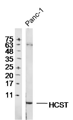 PANC-1 lysates probed with HCST Polyclonal Antibody, Unconjugated (bs-15430R) at 1:300 dilution and 4˚C overnight incubation. Followed by conjugated secondary antibody incubation at 1:20000 for 60 min at 37˚C
