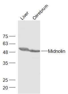 Lane 1: Mouse Liver lysates; Lane 2:Mouse Cerebrum lysates probed with Midnolin Polyclonal Antibody, Unconjugated\r\n(bs-0761R) at 1:300 dilution and 4˚C overnight incubation. Followed by conjugated secondary antibody incubation at 1:10000 for 60 min at 37˚C.
