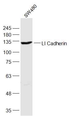 SW480 lysates probed with LI-cadherin Polyclonal Antibody, Unconjugated (bs-1617R) at 1:1000 dilution and 4˚C overnight incubation. Followed by conjugated secondary antibody incubation at 1:20000 for 60 min at 37˚C