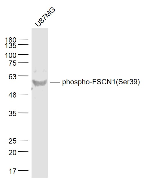 U87MG Cell lysates probed with FSCN1(Ser39) Polyclonal Antibody, Unconjugated (bs-0772R) at 1:1000 dilution and 4˚C overnight incubation. Followed by conjugated secondary antibodyincubation at 1:20000 for 60 min at 37˚C._x000D_