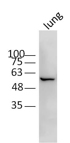 Mouse lung lysates probed with CRMP2/TOAD64 Polyclonal Antibody, Unconjugated (bs-1790R) at 1:300 dilution and 4˚C overnight incubation. Followed by conjugated secondary antibody incubation at 1:20000 for 60 min at 37˚C