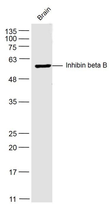 Mouse brain lysates probed with Pro-Inhibin beta B Polyclonal Antibody, Unconjugated (bs-1825R) at 1:500 dilution and 4˚C overnight incubation. Followed by conjugated secondary antibody incubation at 1:20000 for 60 min at 37˚C