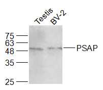 Lane 1: Mouse testis lysates; Lane 2: BV-2 lysate probed with PSAP Polyclonal Antibody, Unconjugated (bs-1879R) at 1:1000 dilution and 4˚C overnight incubation. Followed by conjugated secondary antibody incubation at 1:20000 for 60 min at 37˚C