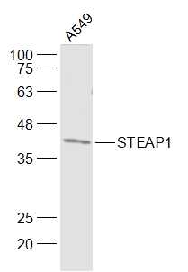 A549 lysates probed with STEAP1 Polyclonal Antibody, Unconjugated (bs-1901R) at 1:1000 dilution and 4˚C overnight incubation. Followed by conjugated secondary antibody incubation at 1:20000 for 60 min at 37˚C