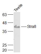 Mouse testis lysates probed with Stra8 Polyclonal Antibody, Unconjugated (bs-1903R) at 1:1000 dilution and 4˚C overnight incubation. Followed by conjugated secondary antibody incubation at 1:20000 for 60 min at 37˚C