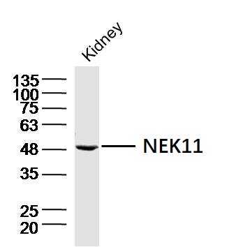 Mouse kidney lysates probed with NEK11 Polyclonal Antibody, Unconjugated (bs-19195R) at 1:300 dilution and 4˚C overnight incubation. Followed by conjugated secondary antibody incubation at 1:20000 for 60 min at 37˚C
