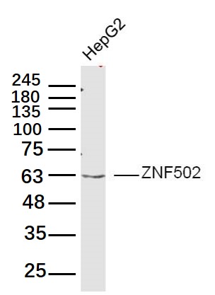 HepG2 lysates probed with ZNF502 Polyclonal Antibody, Unconjugated (bs-19536R) at 1:300 dilution and 4˚C overnight incubation. Followed by conjugated secondary antibody incubation at 1:20000 for 60 min at 37˚C HepG2 lysates probed with ZNF502 Polyclonal Antibody, Unconjugated (bs-19536R) at 1:300 dilution and 4˚C overnight incubation. Followed by conjugated secondary antibody incubation at 1:20000 for 60 min at 37˚C