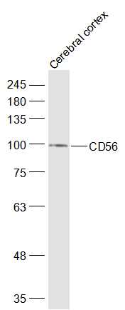 Mouse cerebral cortex lysates probed with CD56 Polyclonal Antibody, Unconjugated (bs-0805R) at 1:1000 dilution and 4˚C overnight incubation. Followed by conjugated secondary antibody incubation at 1:20000 for 60 min at 37˚C.