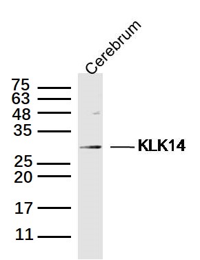 Rat cerebrum lysates probed with Kallikrein 14 Polyclonal Antibody, Unconjugated (bs-1968R) at 1:300 dilution and 4˚C overnight incubation. Followed by conjugated secondary antibody incubation at 1:20000 for 60 min at 37˚C