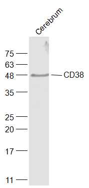 Rat Cerebrum lysates probed with CD38 Polyclonal Antibody, Unconjugated (bs-0979R) at 1:1000 dilution and 4˚C overnight incubation. Followed by conjugated secondary antibody incubation at 1:20000 for 60 min at 37˚C.