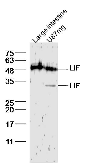 Lane1: Mouse large intestine; Lane2: U87mg cell lysates probed with LIF Polyclonal Antibody, Unconjugated (bs-1058R) at 1:300 dilution and 4˚C overnight incubation. Followed by conjugated secondary antibody incubation at 1:20000 for 60 min at 37˚C.