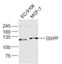 Lane 1: EC-9706 cell lysates; Lane 2: MCF-7 cell lysates probed with DSPP Polyclonal Antibody, Unconjugated (bs-10316R) at 1:1000 dilution and 4˚C overnight incubation. Followed by conjugated secondary antibody incubation at 1:20000 for 60 min at 37˚C.