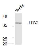 Rat testis lysates probed with LPA2 Polyclonal Antibody, Unconjugated (bs-10368R) at 1:1000 dilution and 4˚C overnight incubation. Followed by conjugated secondary antibody incubation at 1:20000 for 60 min at 37˚C.
