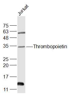 Jurkat cell lysates probed with Thrombopoietin Polyclonal Antibody, Unconjugated (bs-10407R) at 1:300 dilution and 4˚C overnight incubation. Followed by conjugated secondary antibody incubation at 1:20000 for 60 min at 37˚C.