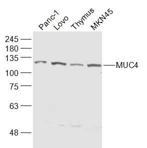 Lane 1: PANC1; Lane 2: LOVO; Lane 3: mouse thymus; Lane 4: MKN45 lysates probed with Mucin 4 Polyclonal Antibody, Unconjugated (bs-1994R) at 1:1000 dilution and 4˚C overnight incubation. Followed by conjugated secondary antibody incubation at 1:20000 for 60 min at 37˚C