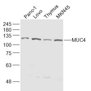 Lane 1: PANC1; Lane 2: LOVO; Lane 3: mouse thymus; Lane 4: MKN45 lysates probed with Mucin 4 Polyclonal Antibody, Unconjugated (bs-1994R) at 1:1000 dilution and 4˚C overnight incubation. Followed by conjugated secondary antibody incubation at 1:20000 for 60 min at 37˚C Lane 1: PANC1; Lane 2: LOVO; Lane 3: mouse thymus; Lane 4: MKN45 lysates probed with Mucin 4 Polyclonal Antibody, Unconjugated (bs-1994R) at 1:1000 dilution and 4˚C overnight incubation. Followed by conjugated secondary antibody incubation at 1:20000 for 60 min at 37˚C