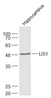 Mouse hippocampus lysates probed with LIS1Polyclonal Antibody, Unconjugated (bs-2035R) at 1:1000 dilution and 4˚C overnight incubation. Followed by conjugated secondary antibody incubation at 1:20000 for 60 min at 37˚C.