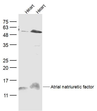 Lane 1: Heart (Mouse); Lane 2: Heart (Rat) lysates probed with ANP Polyclonal Antibody, Unconjugated (bs-2040R) at 1:300 dilution and 4˚C overnight incubation. Followed by conjugated secondary antibody incubation at 1:20000 for 60 min at 37˚C Lane 1: Heart (Mouse); Lane 2: Heart (Rat) lysates probed with ANP Polyclonal Antibody, Unconjugated (bs-2040R) at 1:300 dilution and 4˚C overnight incubation. Followed by conjugated secondary antibody incubation at 1:20000 for 60 min at 37˚C