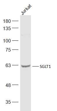 Jurkat cell lysates probed with SGLT1 Polyclonal Antibody, Unconjugated (bs-1128R) at 1:500 dilution and 4˚C overnight incubation. Followed by conjugated secondary antibody incubation at 1:10000 for 60 min at 37˚C.
