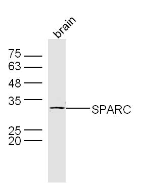 Mouse brain lysates probed with SPARC Polyclonal Antibody, Unconjugated (bs-1133R) at 1:300 dilution and 4˚C overnight incubation. Followed by conjugated secondary antibody incubation at 1:10000 for 60 min at 37˚C.