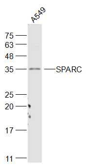 A549 cell lysates probed with SPARC Polyclonal Antibody, Unconjugated (bs-1133R) at 1:1000 dilution and 4˚C overnight incubation. Followed by conjugated secondary antibody incubation at 1:10000 for 60 min at 37˚C.