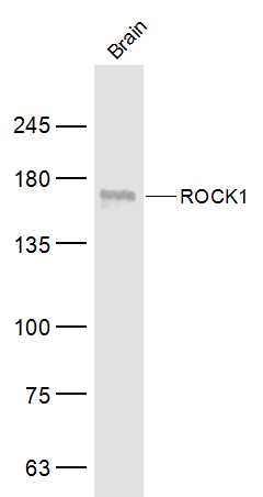 Mouse brain lysates probed with ROCK1 Polyclonal Antibody, Unconjugated (bs-1166R) at 1:500 dilution and 4˚C overnight incubation. Followed by conjugated secondary antibody incubation at 1:10000 for 60 min at 37˚C.